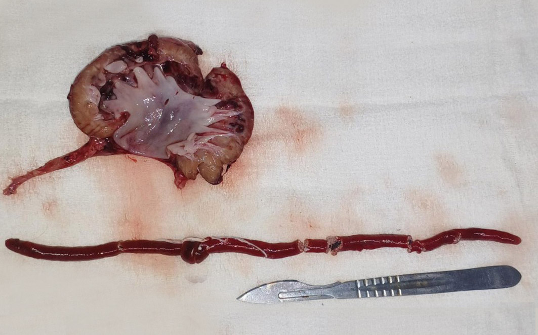 Dioctophyma renale. Créditos: João Helder Frederico de Faria Naves 